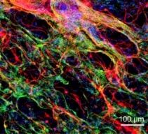 Neuronas y células gliales