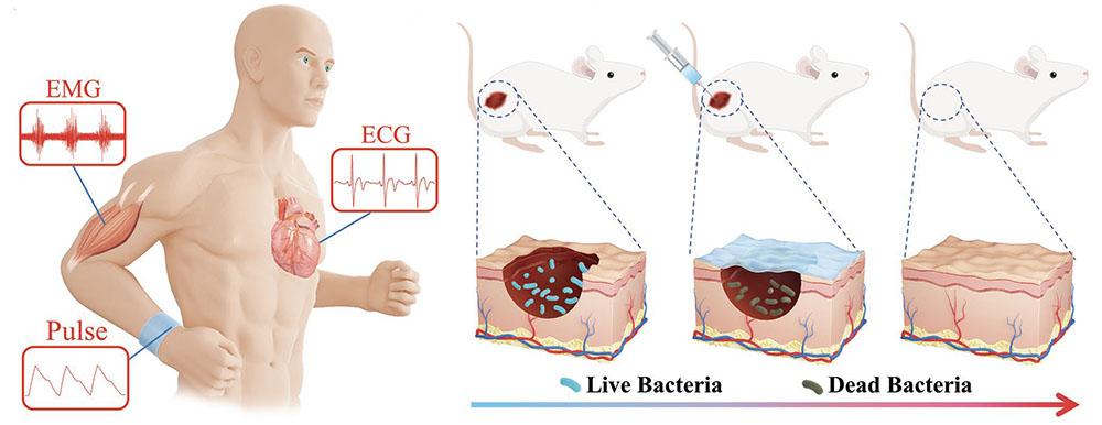 Applications of the MXene hydrogel in human healthcare monitoring and wound therapy