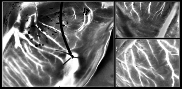 Die Laser-Speckle-Bildgebung erfasst detaillierte Bilder von Blutgefäßen in einem schlagenden Herzen außerhalb des Körpers