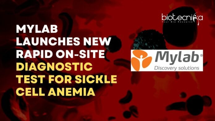Mylab Sickle Cell Anemia