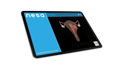 Aplicación de revisor de mapeo de fibromas de Nesa Medtech (FMRA)