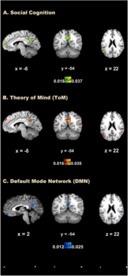 Impacto de los psicodélicos en la DMN, la ToM y la cognición social