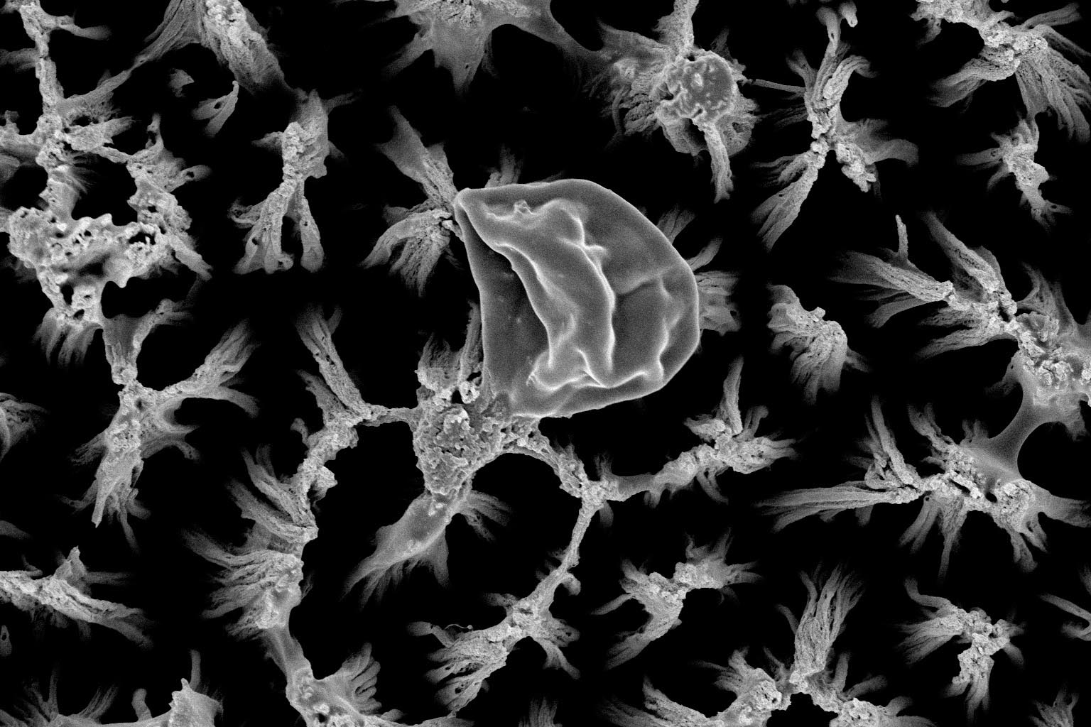 Una célula de Candida rota encima de los micropicos de titanio, ampliada 25,000 veces