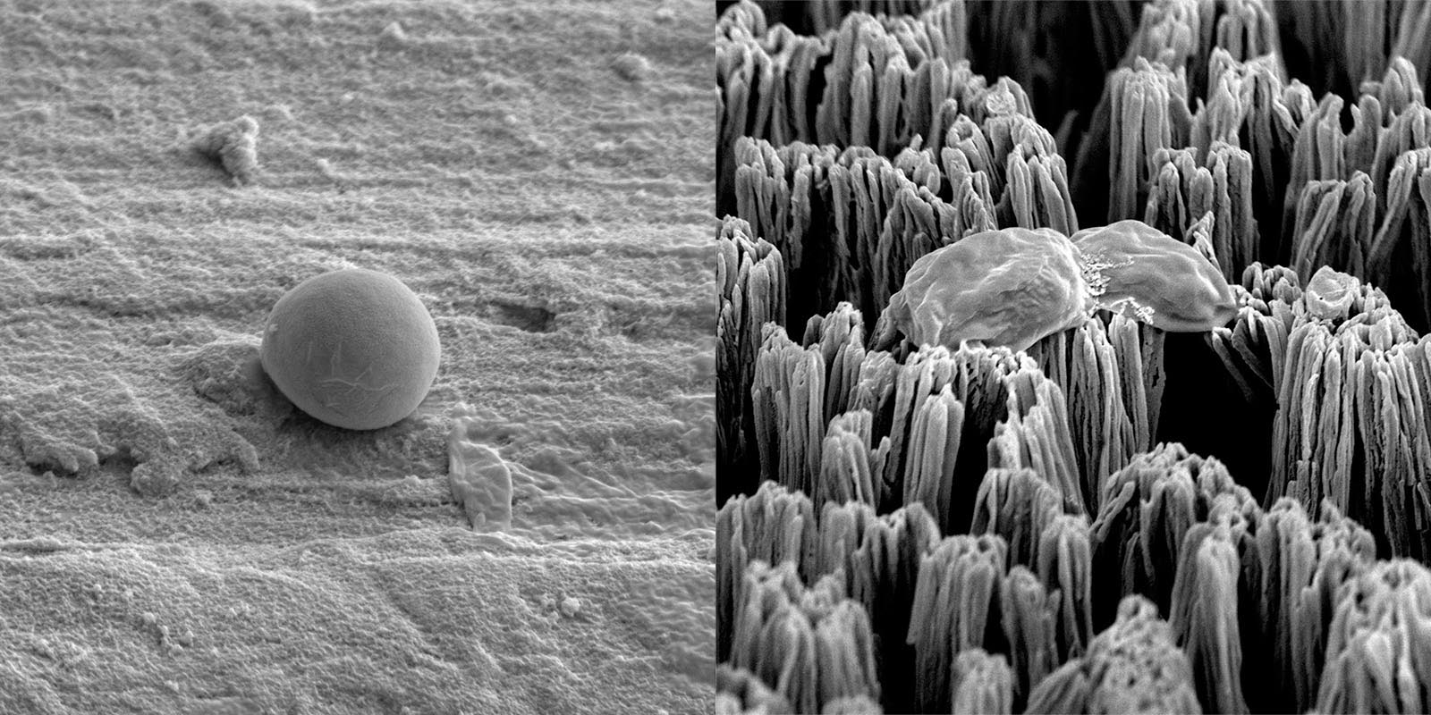 Una célula de Candida intacta sobre una superficie de titanio pulida (izquierda) y una célula de Candida rota sobre una superficie de titanio con micropuntas (derecha)