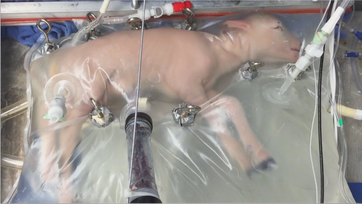 artificial wombs