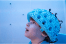 's Werelds eerste draagbare magneto-encefalografiescanner