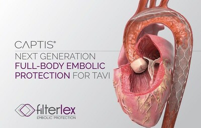 In the new study published in EuroIntervention, Filterlex Medical’s CAPTIS® system captured a high number of embolic debris particles, showing promise in providing embolic protection and enhancing safety during TAVR procedures. (PRNewsfoto/Filterlex Medical)