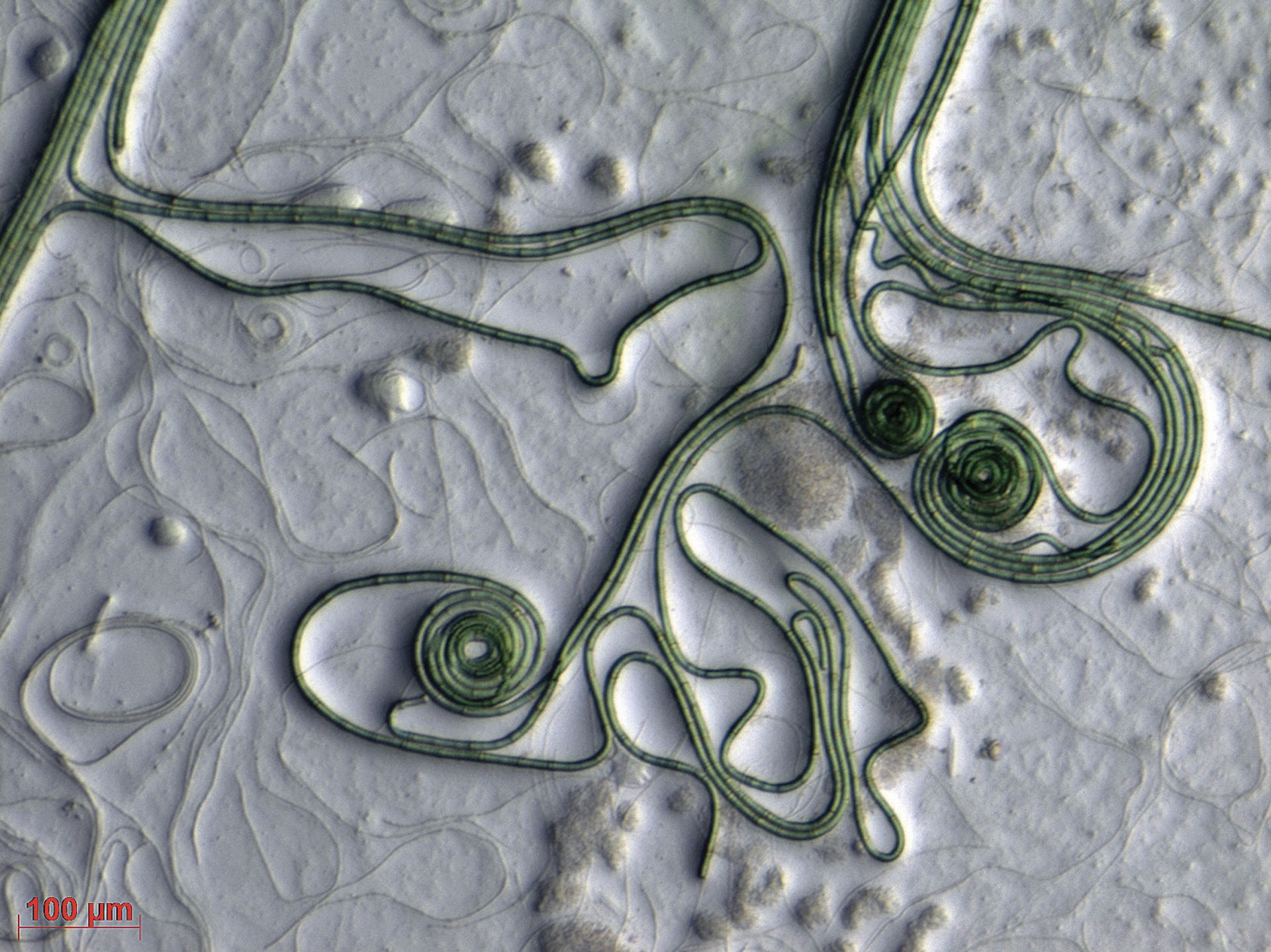 hebras de bacterias parecidas a pelos verdes