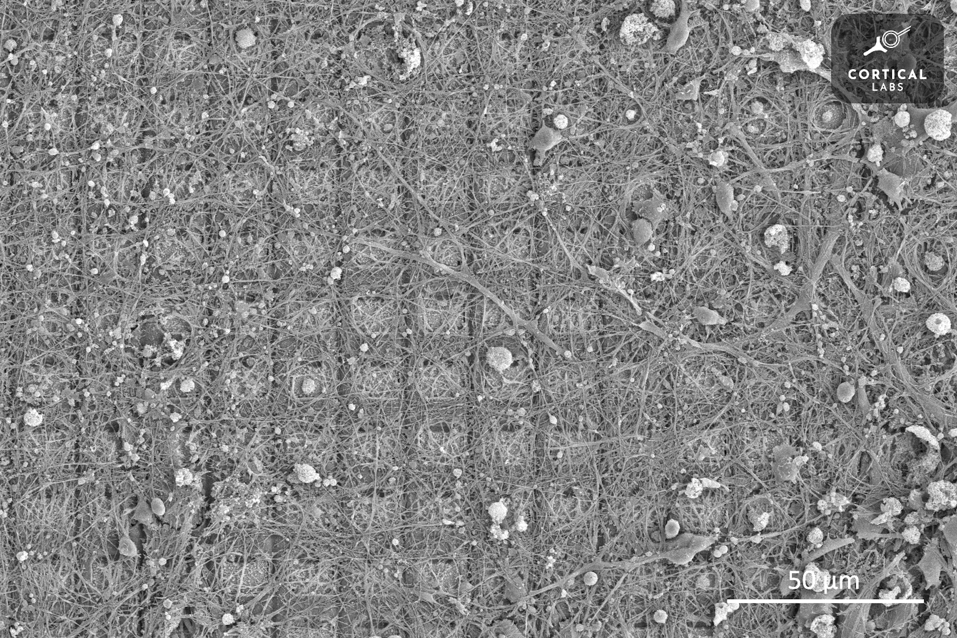 Hình ảnh qua kính hiển vi cho thấy một mạng lưới các ô vuông được bao phủ bởi sự phát triển không đều của các tế bào thần kinh dạng sợi.