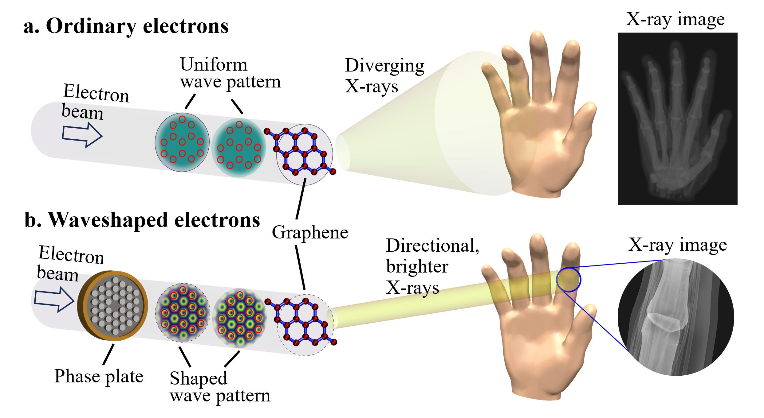 Image aux rayons X d'électrons ordinaires ou d'électrons en forme d'onde