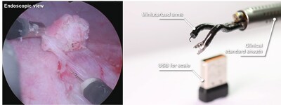 Instrumentos robóticos miniaturizados para cirurgia endoluminal