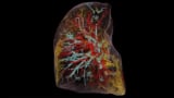 Imagen 3D de un pulmón humano