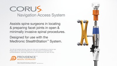 The CORUS™ Navigation Access System assists spine surgeons in locating and preparing facet joints in open and minimally invasive spinal surgery procedures and is designed for use with the Medtronic StealthStation™ System.